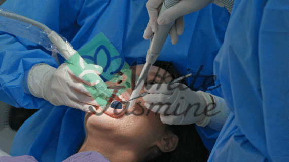 Scaling Gigi di Klinik White Jasmine: Solusi untuk Senyum Sehat dan Percaya Diri