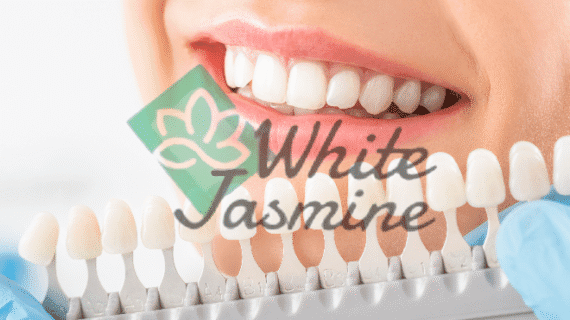 Putihkan Senyummu dengan Bleaching Gigi di Klinik White Jasmine