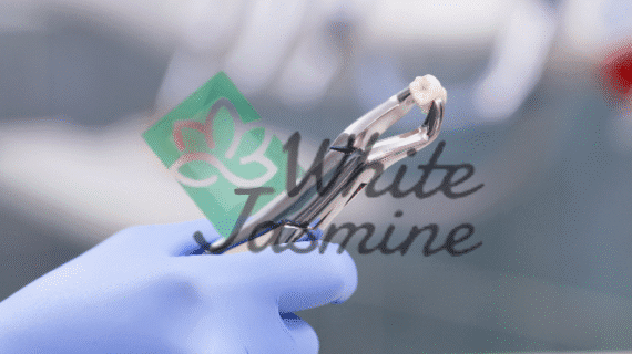 Pencabutan Gigi di Klinik White Jasmine: Aman, Nyaman, dan Profesional