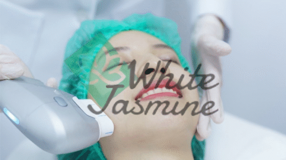 Kulit Kencang dan Awet Muda dengan HIFU Treatment di Klinik White Jasmine