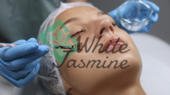 Chemical Peeling di Klinik White Jasmine: Solusi Kulit Cerah dan Sehat